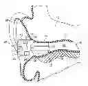 Fig. 01 - Methods and devices for occluding an ear canal having a predetermined filter characteristic