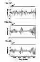 Fig. 32 - DIRECT ECHO PARTICLE IMAGE VELOCIMETRY FLOW VECTOR MAPPING ON ULTRASOUND DICOM IMAGES