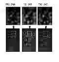 Fig. 33 - DIRECT ECHO PARTICLE IMAGE VELOCIMETRY FLOW VECTOR MAPPING ON ULTRASOUND DICOM IMAGES