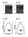 Fig. 35 - DIRECT ECHO PARTICLE IMAGE VELOCIMETRY FLOW VECTOR MAPPING ON ULTRASOUND DICOM IMAGES