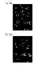 Fig. 40 - DIRECT ECHO PARTICLE IMAGE VELOCIMETRY FLOW VECTOR MAPPING ON ULTRASOUND DICOM IMAGES