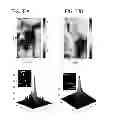 Fig. 42 - DIRECT ECHO PARTICLE IMAGE VELOCIMETRY FLOW VECTOR MAPPING ON ULTRASOUND DICOM IMAGES