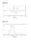 Fig. 43 - DIRECT ECHO PARTICLE IMAGE VELOCIMETRY FLOW VECTOR MAPPING ON ULTRASOUND DICOM IMAGES