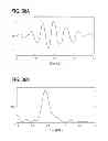 Fig. 45 - DIRECT ECHO PARTICLE IMAGE VELOCIMETRY FLOW VECTOR MAPPING ON ULTRASOUND DICOM IMAGES