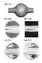 Fig. 54 - DIRECT ECHO PARTICLE IMAGE VELOCIMETRY FLOW VECTOR MAPPING ON ULTRASOUND DICOM IMAGES