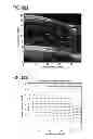 Fig. 71 - DIRECT ECHO PARTICLE IMAGE VELOCIMETRY FLOW VECTOR MAPPING ON ULTRASOUND DICOM IMAGES