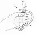 Fig. 01 - Camera stabilizer