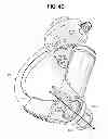 Fig. 07 - Camera stabilizer
