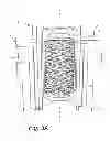 Fig. 05 - Contra rotating wet gas compressor