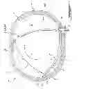 Fig. 02 - Wankel engine rotor