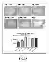 Fig. 31 - Compositions and methods for treatment of intracellular damage and bacterial infection