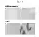 Fig. 09 - COMPOSITIONS AND METHODS FOR FORMATION OF BONE TISSUE