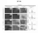 Fig. 16 - COMPOSITIONS AND METHODS FOR FORMATION OF BONE TISSUE