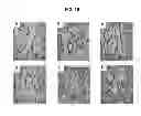 Fig. 22 - COMPOSITIONS AND METHODS FOR FORMATION OF BONE TISSUE