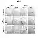 Fig. 30 - COMPOSITIONS AND METHODS FOR FORMATION OF BONE TISSUE