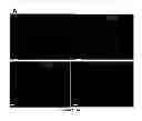 Fig. 02 - Composition and method to improve the therapeutic effect of stem cells