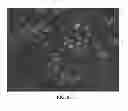 Fig. 09 - METHOD OF DERIVING STEM CELLS, STEM CELLS, AND USE OF STEM CELLS FOR WOUND HEALING