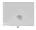 Fig. 10 - METHOD OF DERIVING STEM CELLS, STEM CELLS, AND USE OF STEM CELLS FOR WOUND HEALING