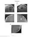 Fig. 09 - Anticaries compositions and probiotics/prebiotics