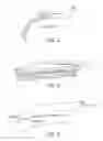 Fig. 04 - Methods and devices suitable for improved reattachment of detached cartilage to subchondral bone