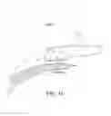 Fig. 07 - Methods and devices suitable for improved reattachment of detached cartilage to subchondral bone