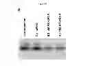 Fig. 27 - Compositions and methods of preventing or ameliorating abnormal thrombus formation and cardiovascular disease