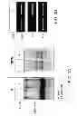 Fig. 05 - Compositions comprising soluble CD84 or anti-CD84 antibodies and methods for diagnosing and treating B-CLL