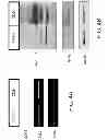 Fig. 06 - Compositions comprising soluble CD84 or anti-CD84 antibodies and methods for diagnosing and treating B-CLL