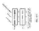 Fig. 16 - Compositions comprising soluble CD84 or anti-CD84 antibodies and methods for diagnosing and treating B-CLL