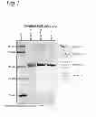 Fig. 02 - Process for detergent-free production of outer membrane vesicles of a gram-negative bacterium