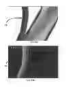 Fig. 12 - Delivery substrates from aligned polymer biomaterials for tissue repair