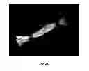 Fig. 23 - Delivery substrates from aligned polymer biomaterials for tissue repair