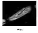 Fig. 24 - Delivery substrates from aligned polymer biomaterials for tissue repair