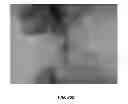 Fig. 26 - Delivery substrates from aligned polymer biomaterials for tissue repair