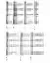 Fig. 05 - MicroRNA-Based Methods and Compositions For the Diagnosis, Prognosis and Treatment of Breast Cancer