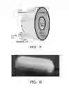 Fig. 02 - Microorganism comprising particles and uses of same