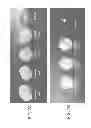 Fig. 08 - Microorganism comprising particles and uses of same