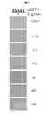 Fig. 04 - Methods of processing fetal support tissues, fetal support tissue powder products, and uses thereof