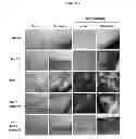 Fig. 20 - Methods of processing fetal support tissues, fetal support tissue powder products, and uses thereof
