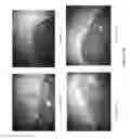Fig. 04 - Gastric health supplement and methods thereof