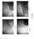 Fig. 05 - Gastric health supplement and methods thereof