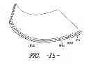 Fig. 14 - POINT BRIDGED FIBER BUNDLE