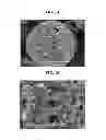 Fig. 02 - Composite anode active material, anode and lithium battery containing the same, and method of preparing the composite anode active material