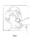 Fig. 07 - COMPUTER-AIDED POSITIONING AND NAVIGATION SYSTEM FOR DENTAL IMPLANT