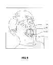 Fig. 08 - COMPUTER-AIDED POSITIONING AND NAVIGATION SYSTEM FOR DENTAL IMPLANT