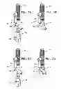 Fig. 04 - DENTAL IMPLANTS, TOOLS, AND METHODS