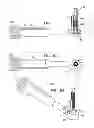 Fig. 07 - DENTAL IMPLANTS, TOOLS, AND METHODS