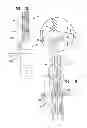 Fig. 13 - DENTAL IMPLANTS, TOOLS, AND METHODS