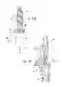 Fig. 16 - DENTAL IMPLANTS, TOOLS, AND METHODS