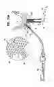 Fig. 29 - DENTAL IMPLANTS, TOOLS, AND METHODS